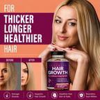 Advanced Hair Growth Capsules | For Postpartum, Hormonal & Thinning Hair