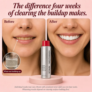 STAIN Whitening Mouthwash